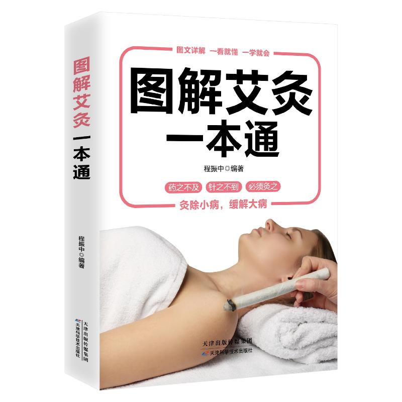 醉染图书图解艾灸一本通:经典彩图版9787530885727