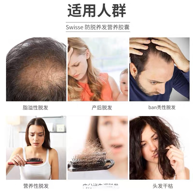 Swisse女士头发营养复合胶囊60粒/瓶装 澳洲原装进口 复合维生素