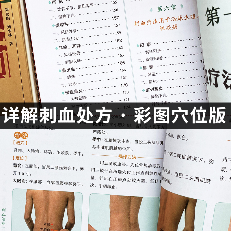 7册 刺血治病 找穴取穴 人体经络 食疗等书 [正版]抖音同款全2册 刺血治病一本通+中国民间刺血术中医书籍 刘光瑞原著高清大图