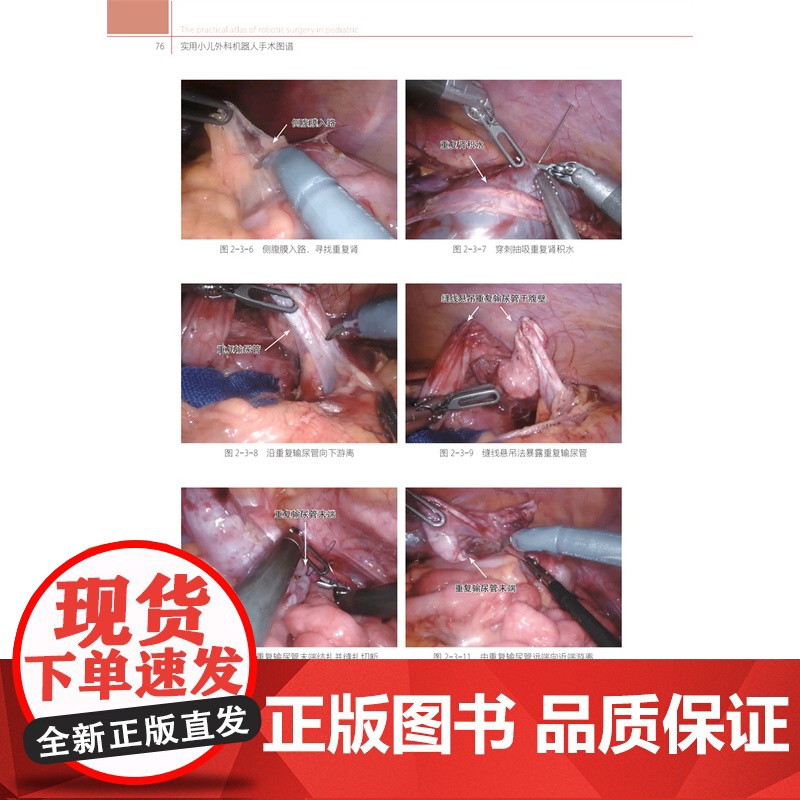 [店]实用小儿外科机器人手术图谱高清大图