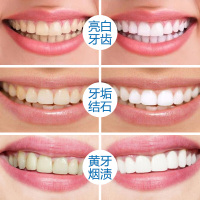 倩滋洗牙粉炫白亮白牙齿 男女适用去黄牙烟牙黑牙污垢牙齿 刷牙洁净牙齿50g/盒