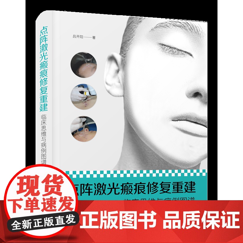 点阵激光瘢痕修复重建:临床思维与病例图谱 大量精选病例高清图片,多维展示瘢痕发展的全过程