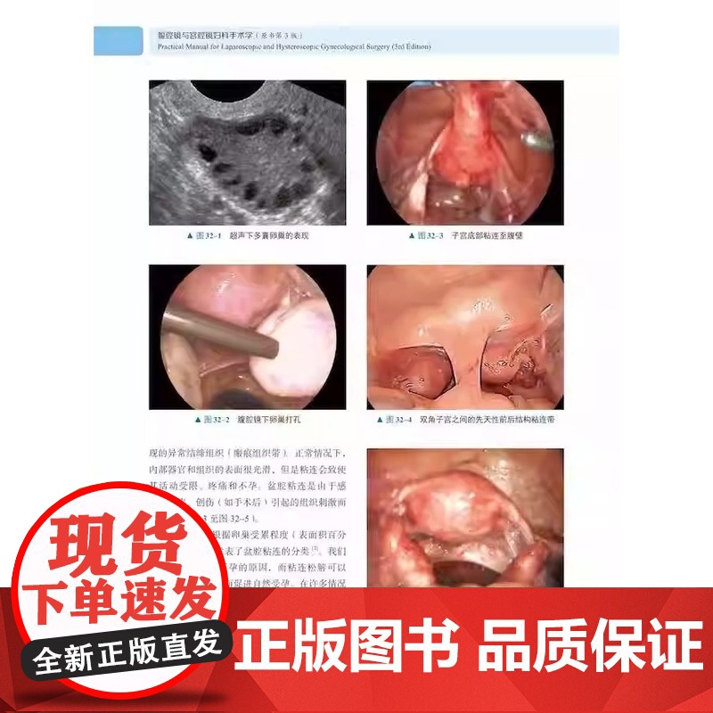 腹腔镜与宫腔 镜妇科手术 学原书第3版 全书分50章从妇科内 镜技术 的发展历史到 设备仪器 进化迭代的 历程高清大图