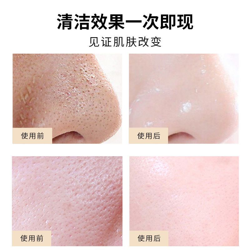 韩芭莎撕拉面膜去黑头去斑清洁面膜美白淡斑洁面面膜清洁净面膜GP 体验装(发1瓶)