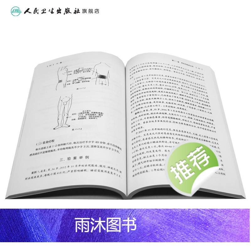 [正版]热敏常灸出奇效 慢病康复新选择 2020年11月参考书 人民卫生出版社高清大图