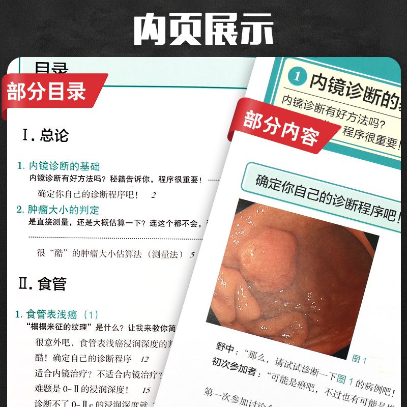 [醉染正版]上消化道内镜诊断秘籍 日 野中康一 食管表浅癌Barrett食管腺癌胃溃疡早期胃癌鉴别诊断书籍 内镜诊断与鉴高清大图