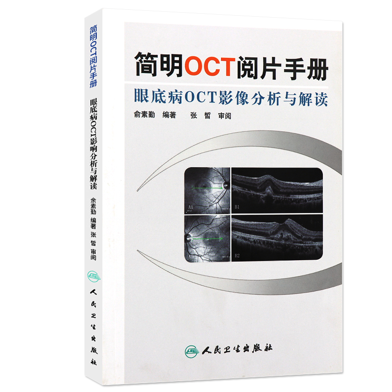 [正版] 简明OCT阅片手册 眼底病眼科OCT影像分析与解读 俞素勤编著 基础阅片影像眼科学视光技术应用 人民卫生出版高清大图