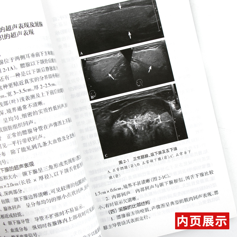 [正版]新品 中国浅表器官超声检查指南 中国医师协会超声医师分会指南丛书 影像医学 中国医师协会超声医师分会 著 人民