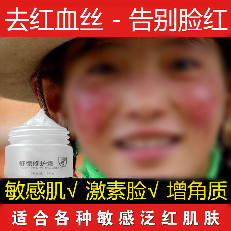 舒缓修复霜去红血丝修复角质层薄男女士通用祛脸红脸蛋面霜修复肌肤泛红干痒过敏红斑 舒缓修复霜