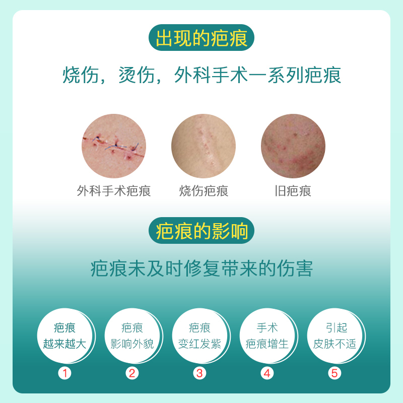 素美颜疤痕修复剂疤膏儿童疤痕贴剖腹产手术烫伤膏硅酮疤痕凝胶双眼皮疤痕膏去疤痕膏面部祛疤膏 1盒(体验装)