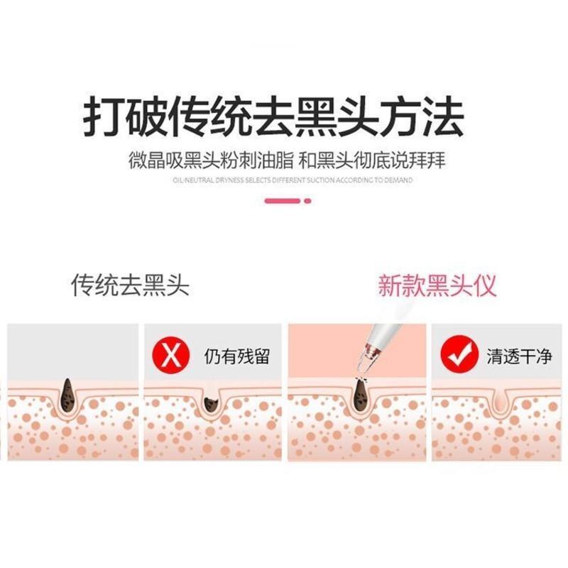 璐瑶吸黑头神器电动去黑头粉刺洁面仪清洁毛孔仪器学生收缩毛孔 传统版黑头仪(电池款)