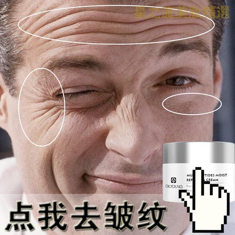 优选好货专营好货除皱纹神器去皱纹抬头纹祛皱男抗皱紧致面霜男士去皱