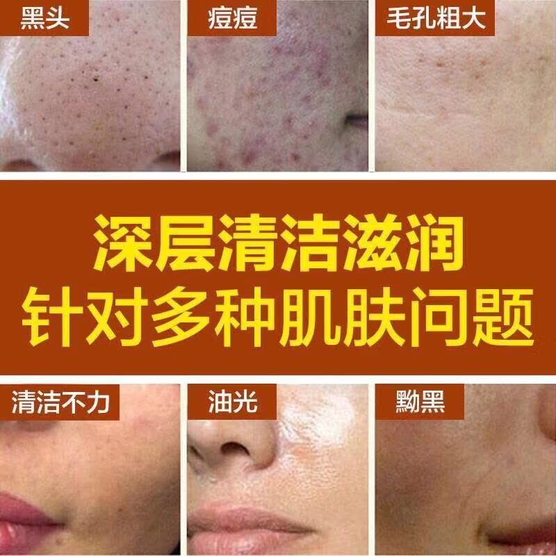 芦荟洗面奶补水保湿控油祛斑淡痘印收缩毛孔深层清洁面乳男女 芦荟洗面奶100g+蜂胶面膜10片图片