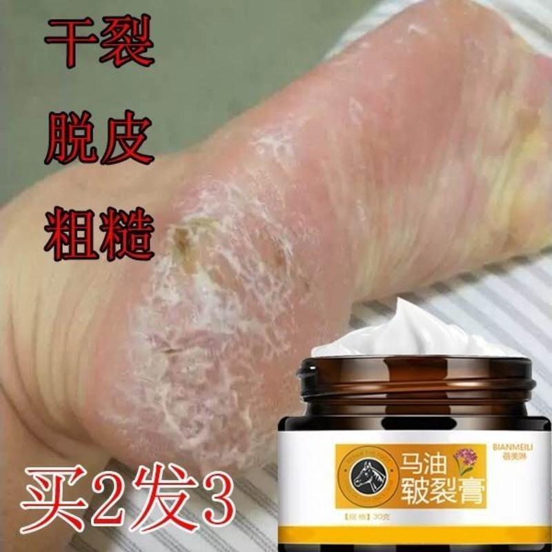 手脚干裂粗糙脱皮皲裂膏马油保湿滋润膏冬季护手护脚膏 鵛**一瓶发
