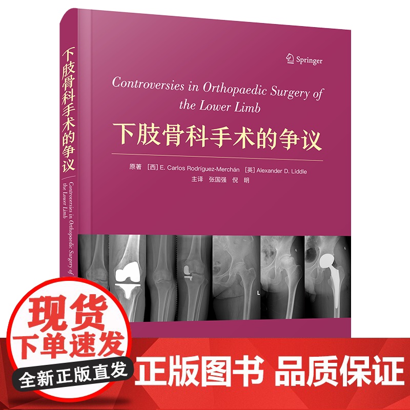 下肢骨科手术的争议 一部专门分析近年来有关下肢关节矫形手术方面各种关键争议性问题的著作