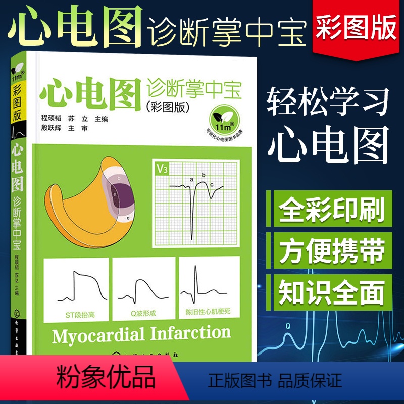 [正版]心电图诊断掌中宝 彩图版 临床心电图书籍高手速成诊断手册图谱书轻松学习心电图彩色简明心电图学入门基本图形各种波
