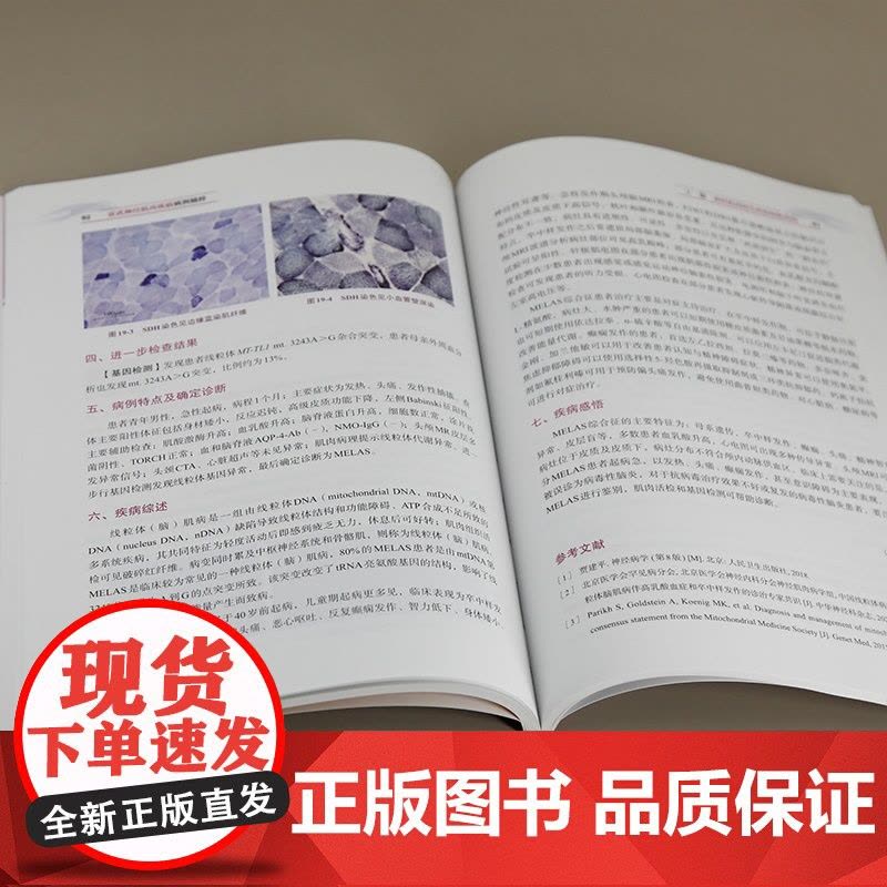 [正版新书]宣武神经肌肉疾病病例精粹 笪宇威 清华大学出版社 神经病学 神经肌肉疾病 罕见病图片