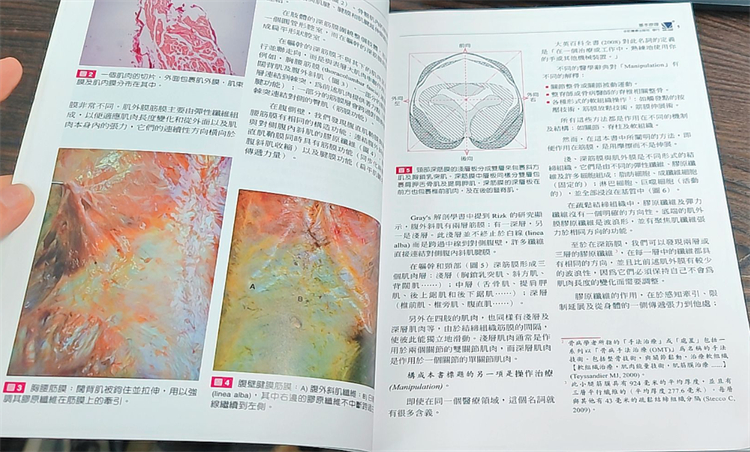 [正版] 筋膜操作治疗术:针对肌肉骨骼疼痛处置 18 Luigi Stecco; Antonio Sstcco高清大图