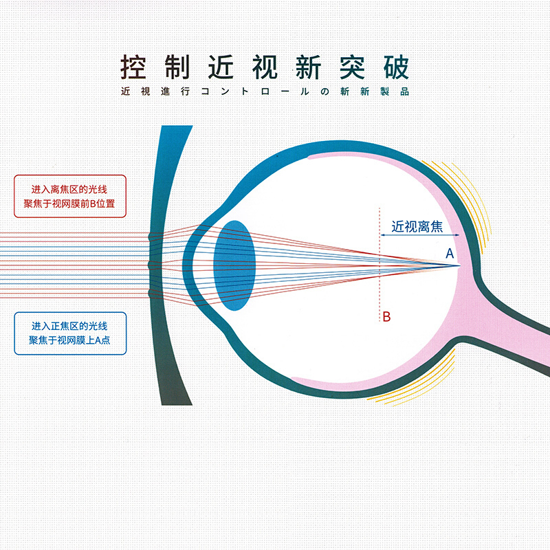 [顺丰]尚境HOYA/豪雅新乐学多点离焦镜片1.59新乐学镜片学生儿童近视镜片高清大图