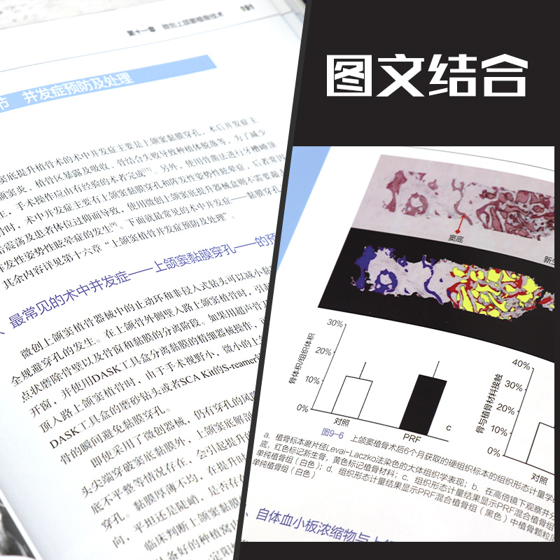 [正版] 上颌窦植骨与种植书 林野 主编 口腔种植学书籍和牙手术学图解美学区域的修复精准植入技巧数字化实用技术精要现代高清大图