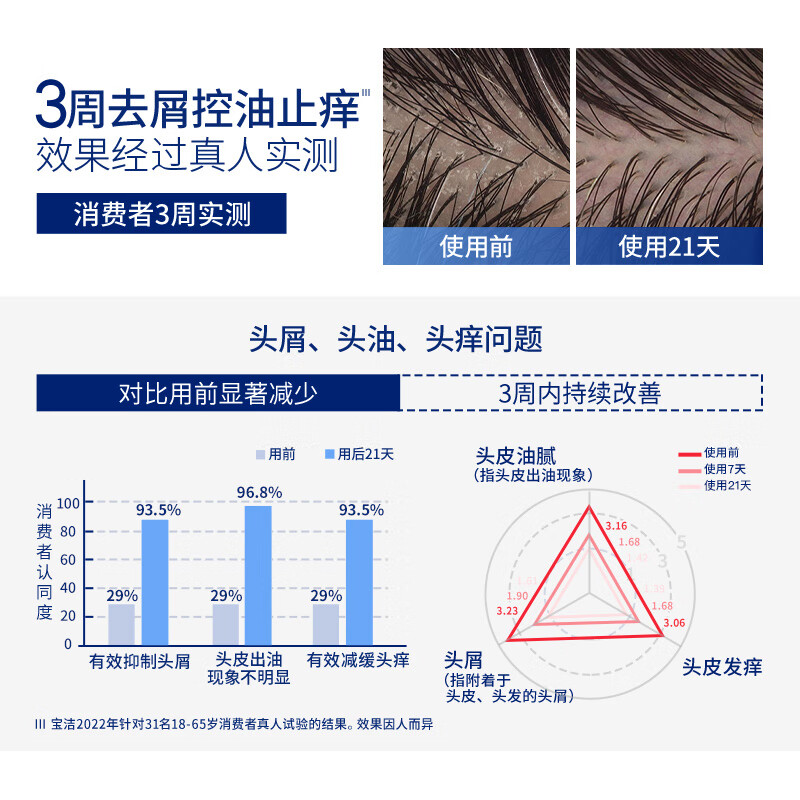 海飞丝 专研去屑洗发水 80g 控油去屑洗发水试用装旅行装高清大图