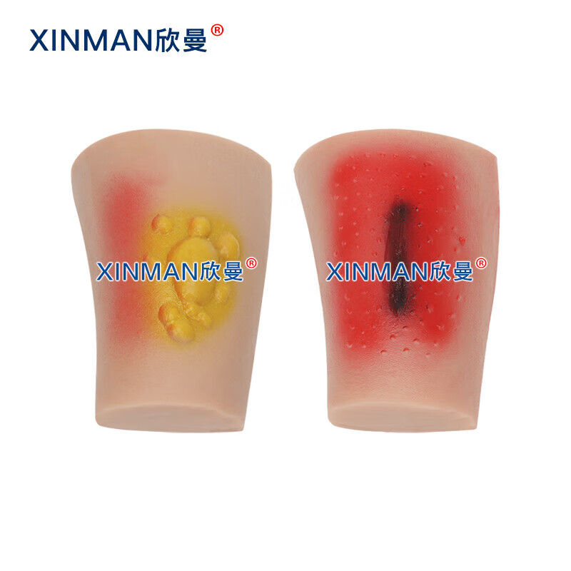 欣曼科教 人员中毒仿真模型 神经性中毒 芥子气中毒 路易氏剂中毒 教学用模型XM-SQ16A高清大图