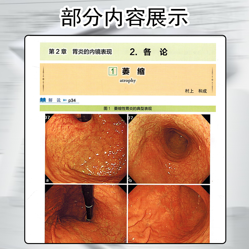 [书]京都胃炎分类 吴永友,李锐主译 消化内科学临床案例诊治教程胃炎内镜诊断技术胃肠疾病参考工具书籍 [正版]书京都胃炎高清大图