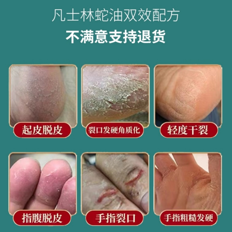[买1送1]金丫手霜足霜手裂脚裂脱皮皲裂霜滋养保湿预防干裂刺孕妇儿童适用30g高清大图