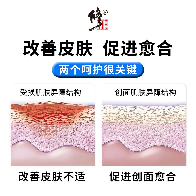 修正湿疹喷雾剂私处肛门屁股肛周湿疹瘙痒