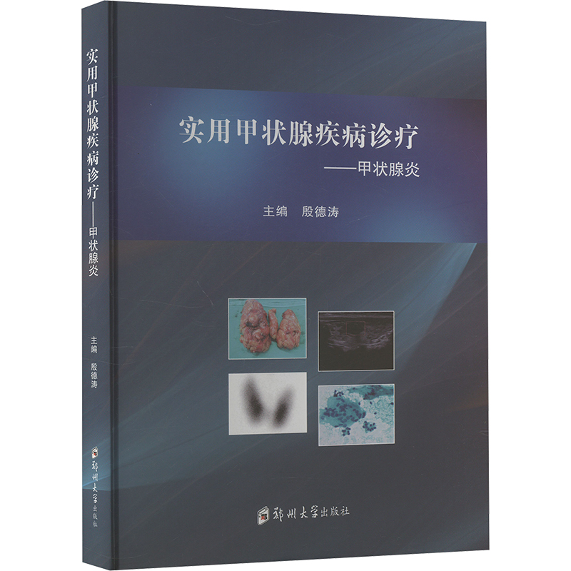 【N】实用甲状腺疾病诊疗——甲状腺炎-9787577308753