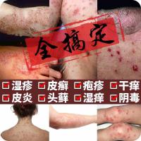 【苏宁正品】本姥姥灵霜彭囊肛瘙痒皮肤股藓牛皮藓头藓外用清肤宝妮堂帕芙欧珍肤膏疹净珍安霜张氏御衙肤爽康药 百峰 藏药湿毒王