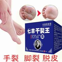 男士嫩手神器去死皮的护手霜愈裂霜手足防脚干裂开裂脱皮脚跟防裂膏止痒去手脚死皮皲裂膏保湿