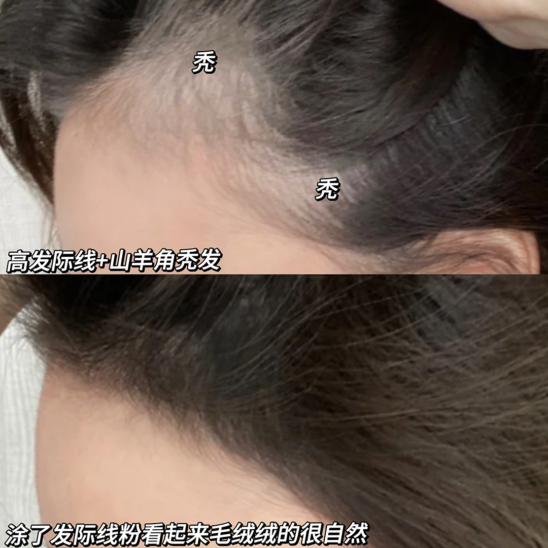发际线粉防水防汗正品发缝填充遮盖神器补发棒遮白发笔蓬蓬粉自然3759A高清大图