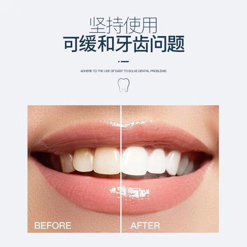 上牙套【附带使用说明】 收到商品不懂的请一定要咨询客服 牙套吃饭神器假牙套牙仿真缺牙临时牙套 遮盖门牙缺牙临时牙填充