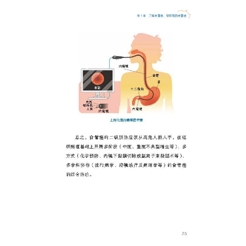 正版新书]全面说食管癌陈小兵,高社干9787523602935高清大图
