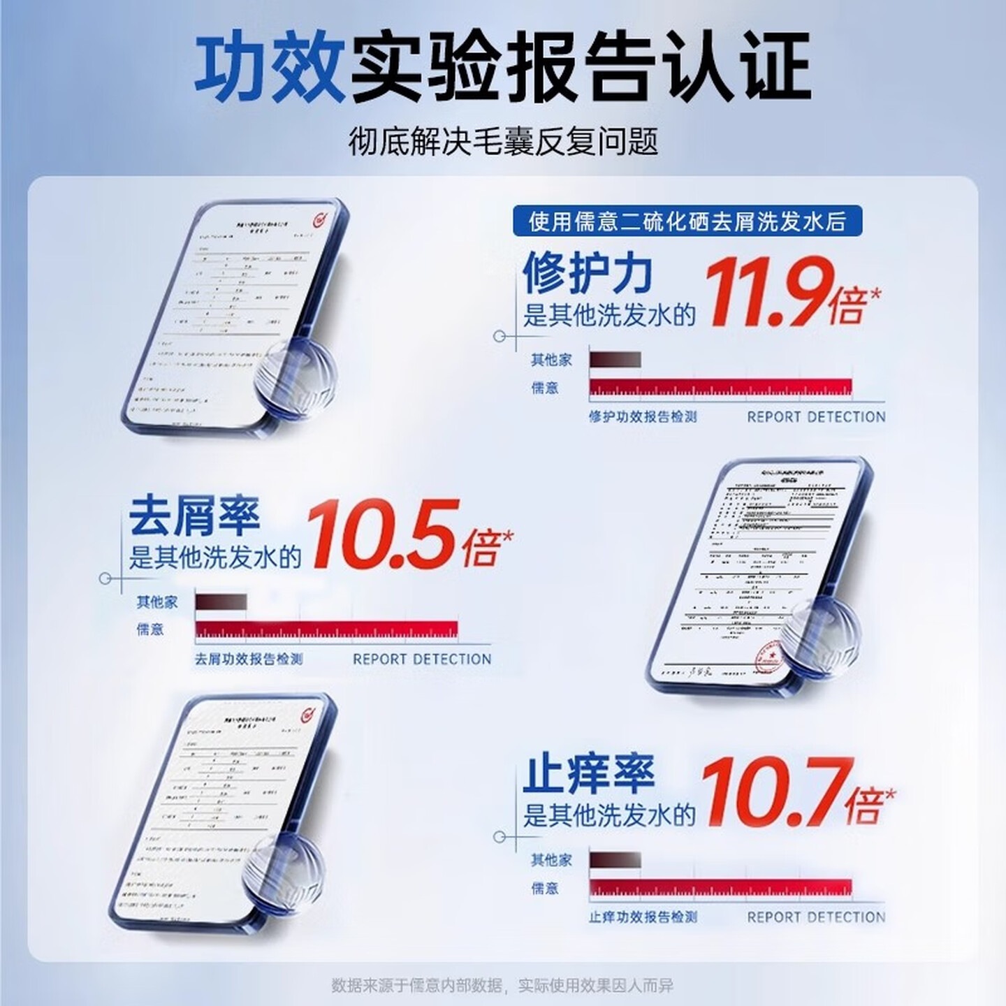 儒意(RUYI)二硫化硒洗发水去屑止痒控油持久蓬松男女士洗头膏露500ml高清大图