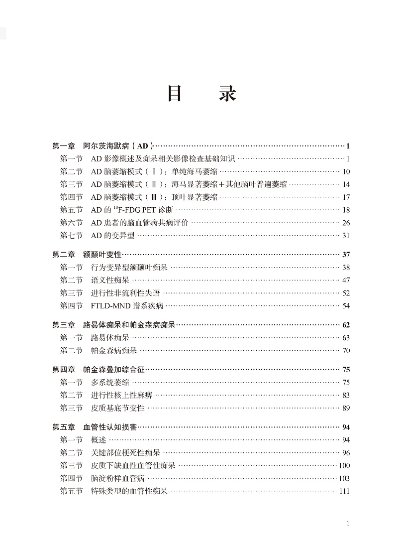 [醉染正版] 正版 实用痴呆神经影像图谱 郑东明 编著 北京大学医学出版社 9787565926143高清大图
