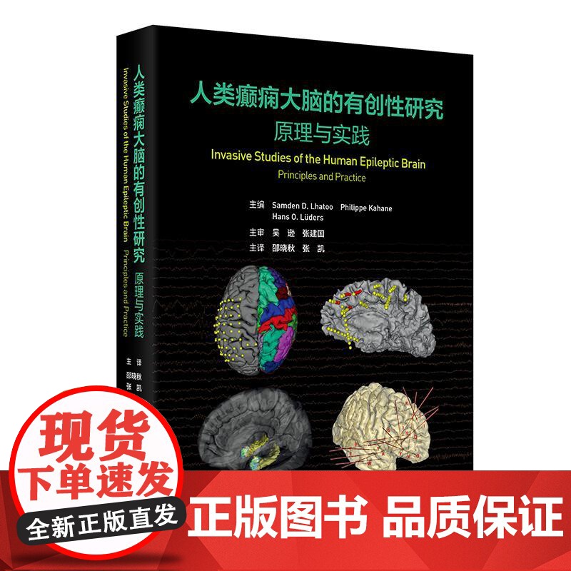 人类癫痫大脑的有创性研究 原理与实践 邵晓秋 张凯 主译 该书系统介绍了癫痫灶和大脑功能区的定位原理和方法等 人民卫生出高清大图