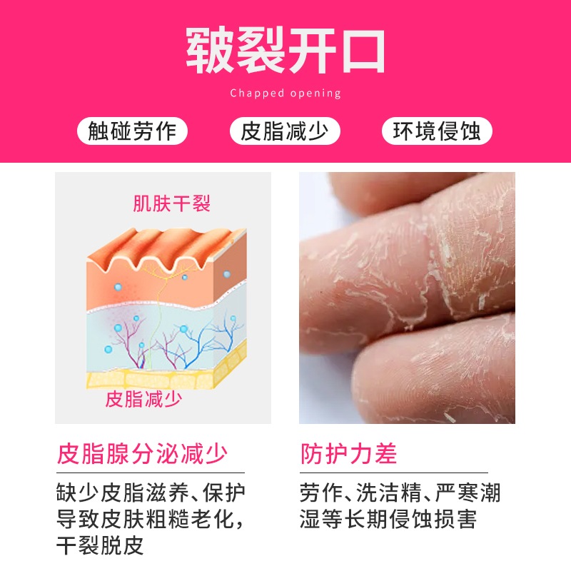 英滴 皲裂护理霜50g 手脚裂口干燥保湿滋润清爽不油腻高清大图