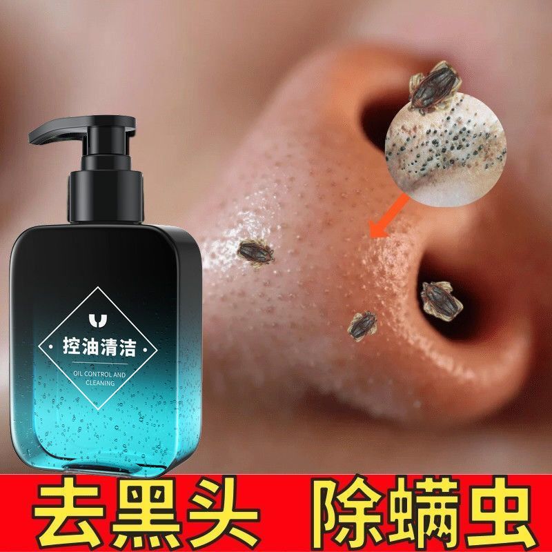 洗面奶男士专用控油祛痘除螨虫粉刺美白去黑头收缩毛孔学生青少年 [特惠]祛痘控油洗面奶1瓶