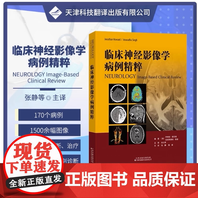 临床神经影像学病例精粹 神经系统疾病影像学 癫痫 脑血管病 自身免疫疾病 脱髓鞘性疾病等 神经病学领域 张静 陈薇主译