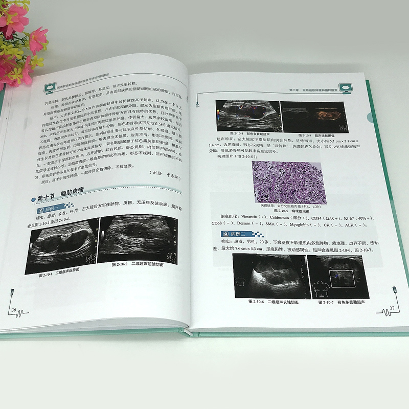 [正版] 浅表软组织疾病超声诊断与病理对照图谱 刘勋 魏玺 临床医学 超声学书籍 9787518973743 科学技术高清大图
