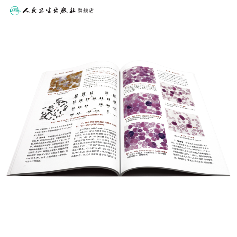 [正版]实用血液学图谱 管洪在刘成玉内科学搭威廉姆斯血液学血细胞染色体骨髓细胞临床实用血液病外周血人民卫生出版社高清大图
