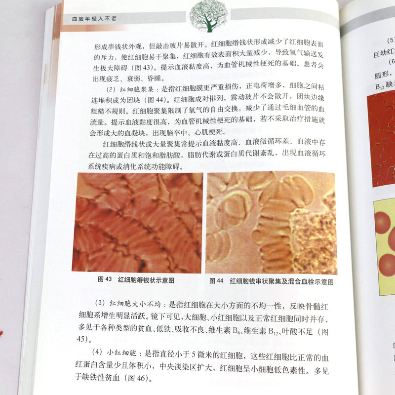 [醉染正版]血管决定人的寿命+血液年轻人不老 中医气血养生 营养食谱健康护理书籍调理保健养生排毒调理养命之方中医养生书籍高清大图