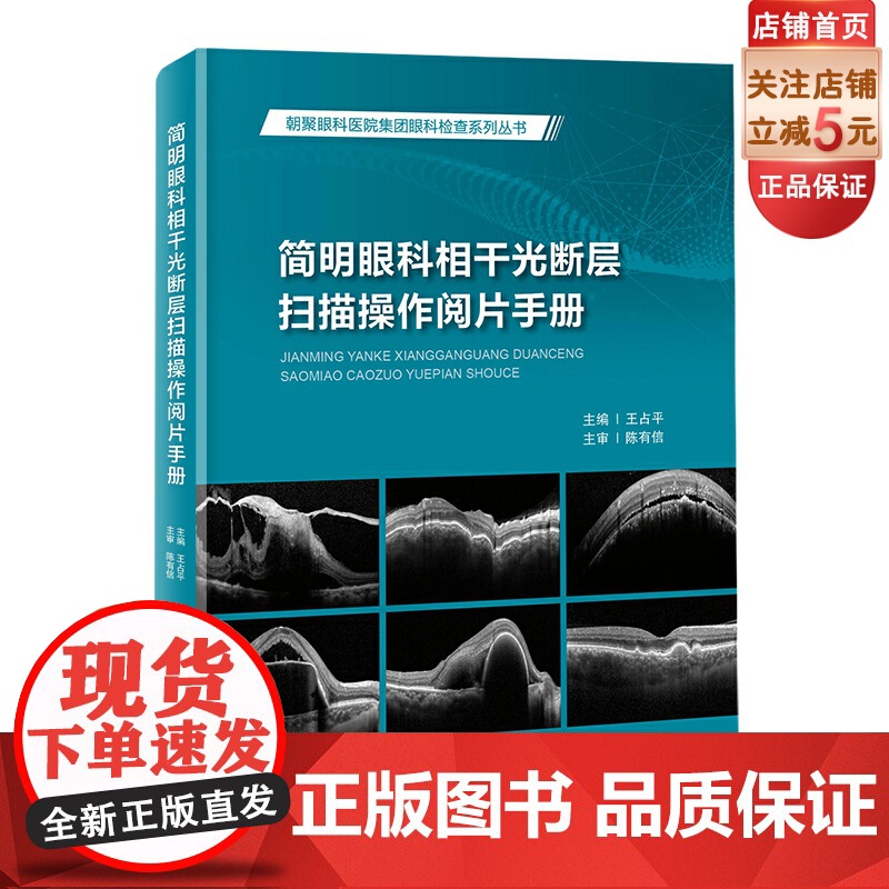 简明眼科相干光断层扫描操作阅片手册 图文并茂 病例分析 北京科学技术