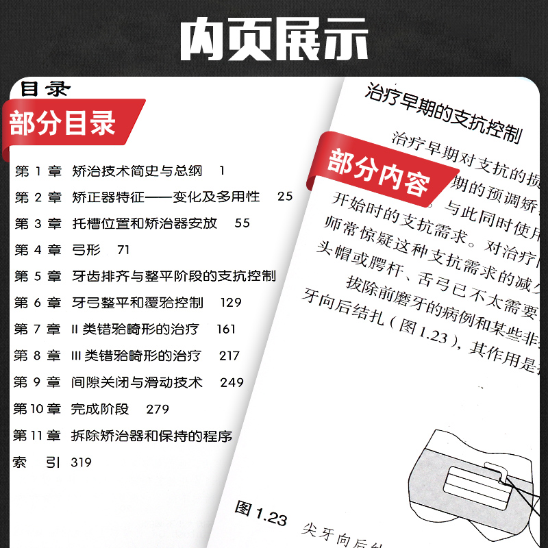 [正版]系统化正畸治疗技术 麦克劳夫林 天津科技翻译出版公司 口腔正畸学 口腔医学类专业书籍 医学 正畸书 外科学 9高清大图