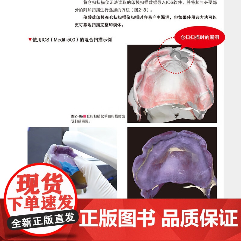 [出版社]数字化全口吸附性义齿新时代 山崎史晃 著 扫描仪和软件差异分析义齿制作方法口腔美容种植 辽宁科学技术出版社高清大图
