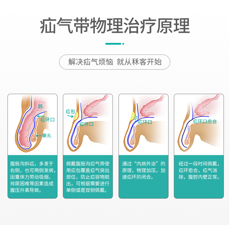 秝客(lefeke)疝气带(器械)疝气固定带腹股沟疝气带成年男性老人成人中年女小肠气疝气裤头抗菌防螨透气亲肤材质四季可用高清大图