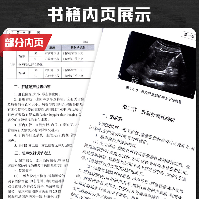 [正版]中国腹部超声检查指南 中国医师协会超声医师分会指南丛书 超声检查规范和疾病诊断基础 中国医师协会超声医师分会高清大图