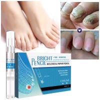 买一支发二支6ML 告别灰指甲]原REAM成膜技术灰甲一笔亮灰甲液生长修护液亮甲专用